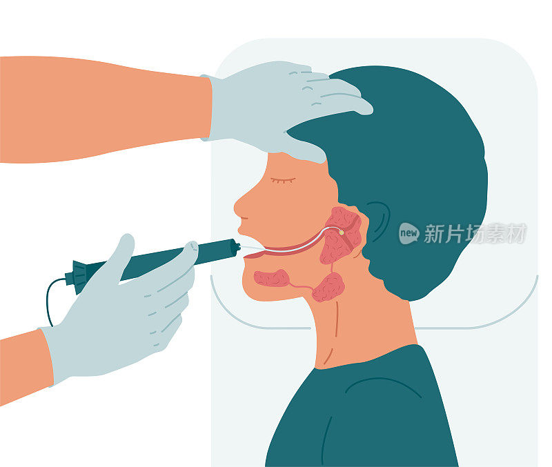 Surgery to remove a stone from the duct of the parotid salivary gland.
